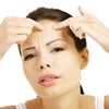 Acne-causes-uncovered_360_381275_1_14084308_100.jpg