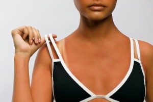 Body detox alternatives for weathering a sunburn