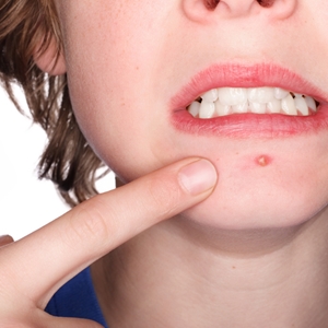 Is stress a factor in your beauty?