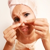 The-truth-about-adult-acne_360_399050_1_14085243_100.jpg