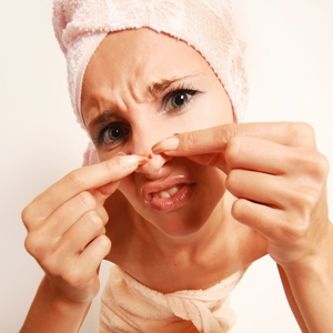 The truth about adult acne